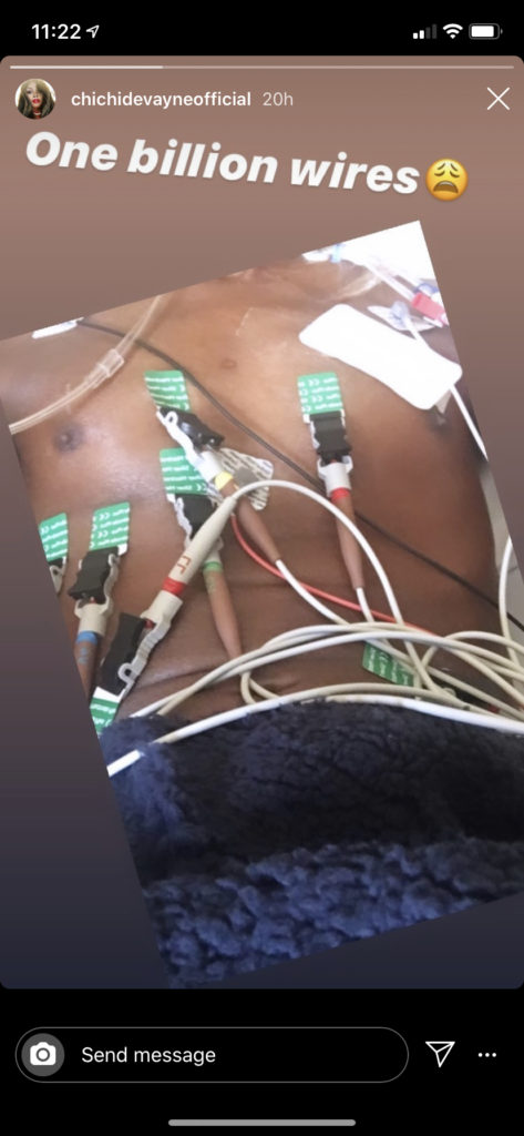 Torse de Chi Chi DeVayne avec des fils attachés
