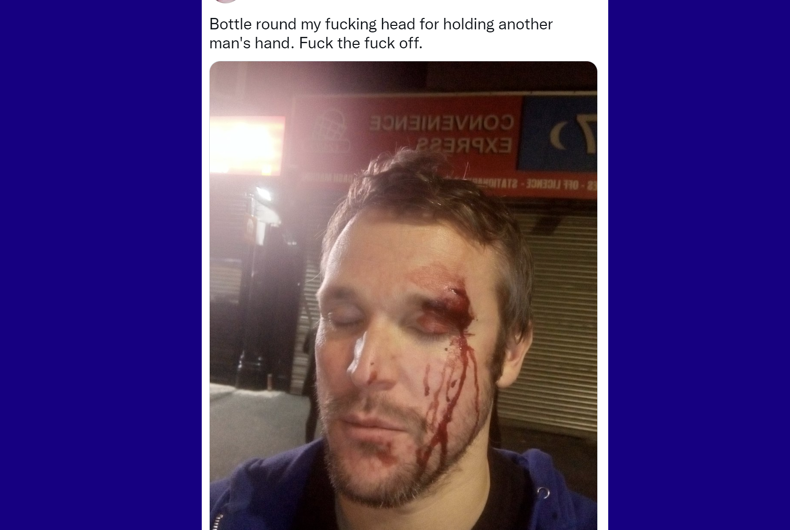 John Paul Kessler a tweeté à propos de l'attaque peu de temps après qu'elle s'est produite