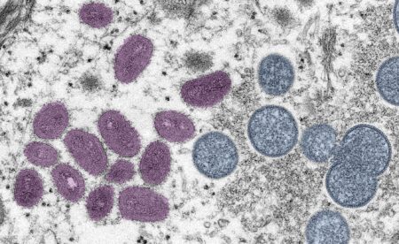 Digitally-colorized electron microscopic (EM) image depicting a monkeypox virion (virus particle)