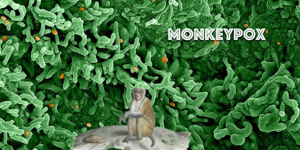 Vaccin Monkeypox : « Où est le reste des nôtres ? » Responsables locaux de la santé aux autorités fédérales monkeypox vaccine