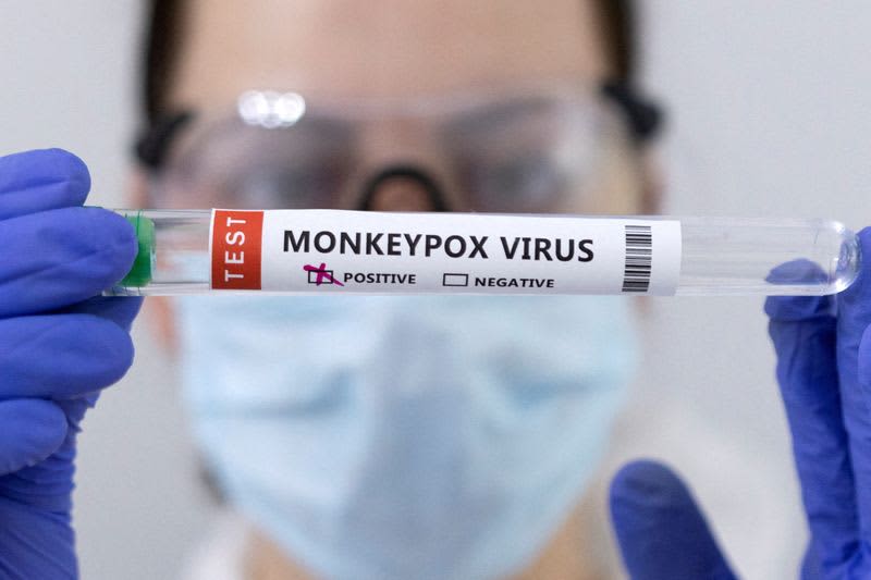 Les régulateurs américains défendent l’exigence de plus de données sur le médicament monkeypox 634516 origin 1