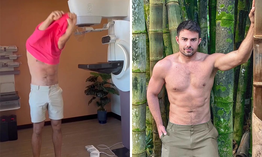 Jonathan Bennett, star de « Mean Girls », a filmé sa mammographie Jonathan Bennett, star de "Mean Girls", a filmé sa mammographie
