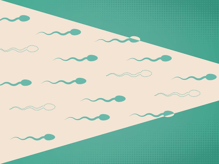 Les options de contrôle des naissances masculines sont en développement, mais un certain nombre d'obstacles se dressent encore sur le chemin