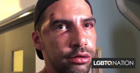 Quatre hommes ont battu un couple gay pour s'être tenu la main après Pride.  Ils s'en sont sortis sans peine de prison.