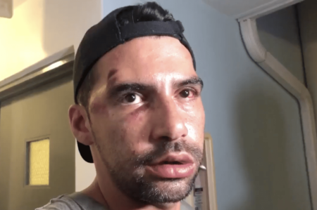 Rene Chalarca after the Florida attack