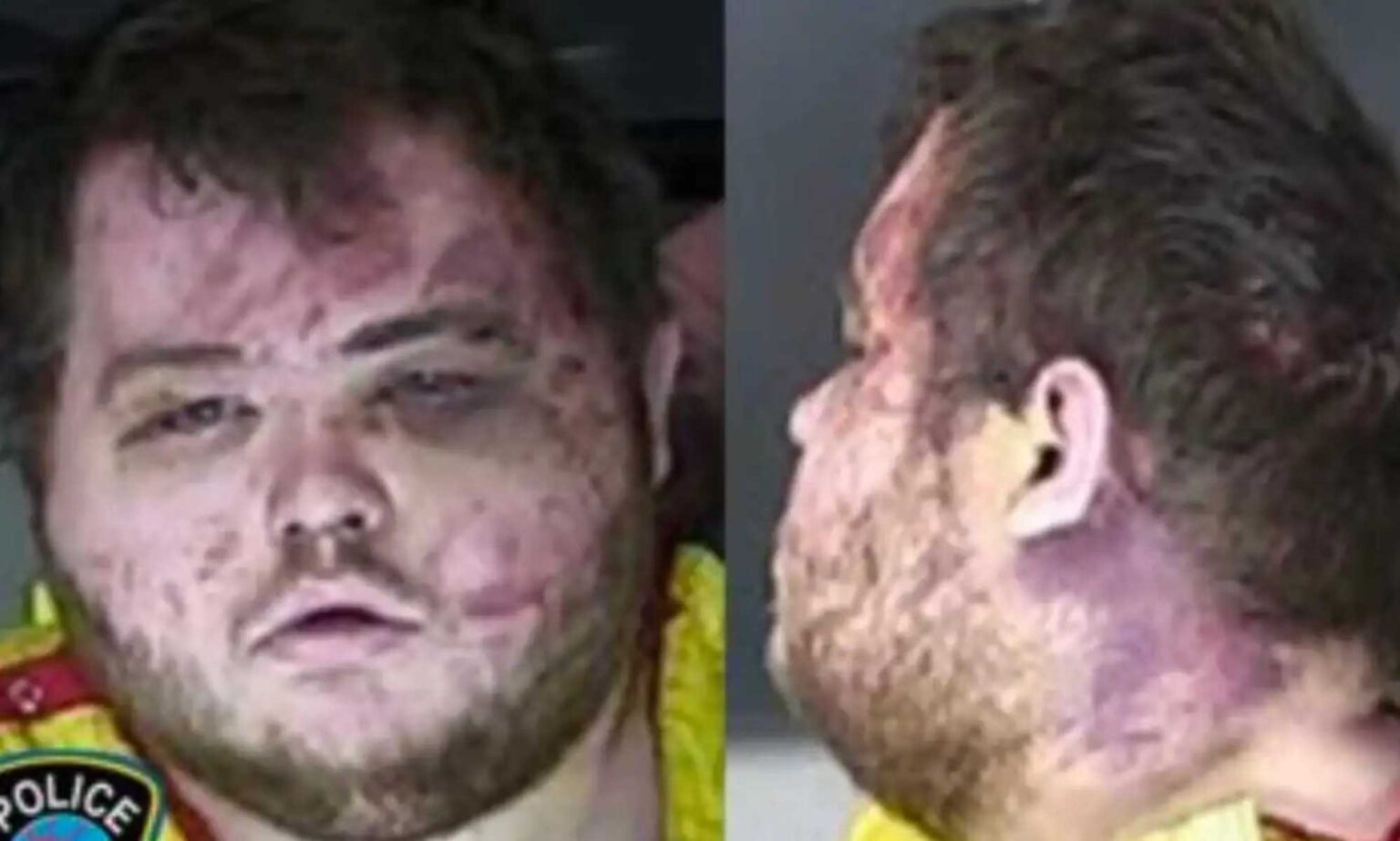 Le suspect de la fusillade du Club Q sera jugé pour crime de haine – mais le procès pourrait ne pas avoir lieu avant «l’année prochaine» Anderson Lee Aldrich