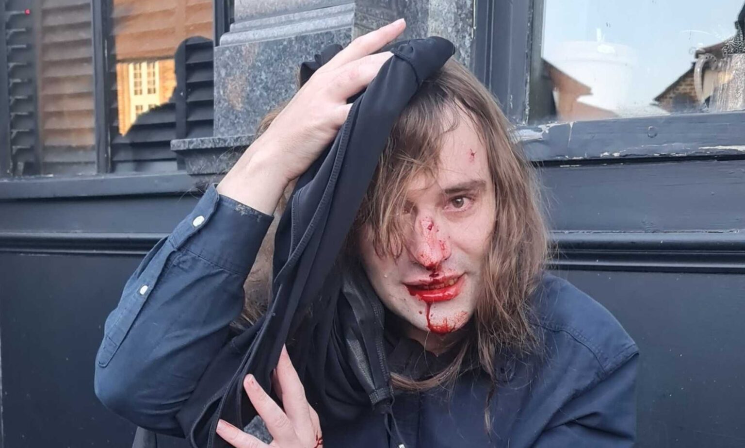 Met admet qu’il est « possible » qu’un activiste LGBTQ+ ait été blessé par un officier lors d’une manifestation chaotique anti-drag Injured activist