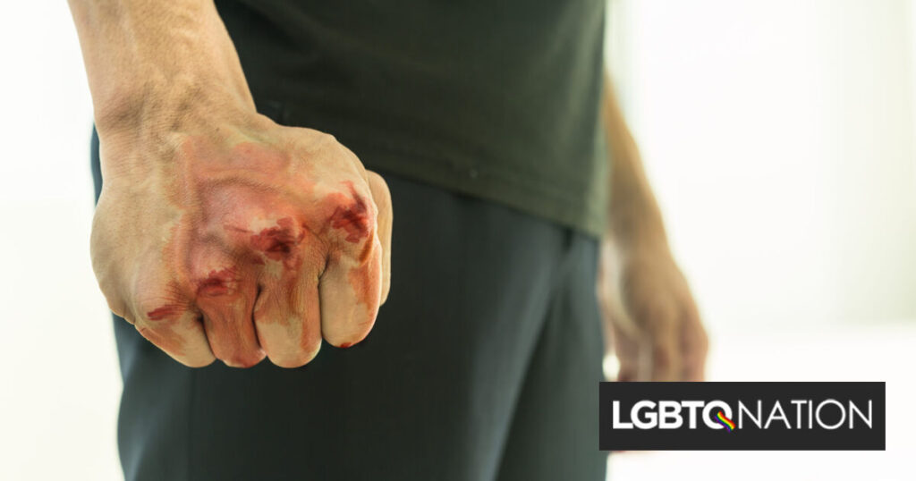 Un couple gay ivre a cassé la mâchoire d’un homme après avoir mal interprété une insulte homophobe Un couple gay ivre a cassé la mâchoire d'un homme après avoir mal interprété une insulte homophobe