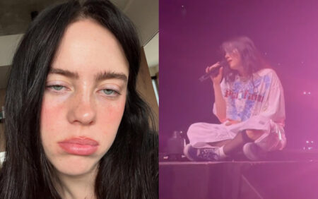 Billie Eilish frappée au visage par un bracelet lors de la représentation de What Was I Made For ?