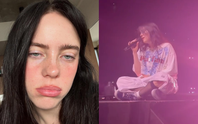Billie Eilish frappée au visage par un bracelet lors de la représentation de What Was I Made For ?