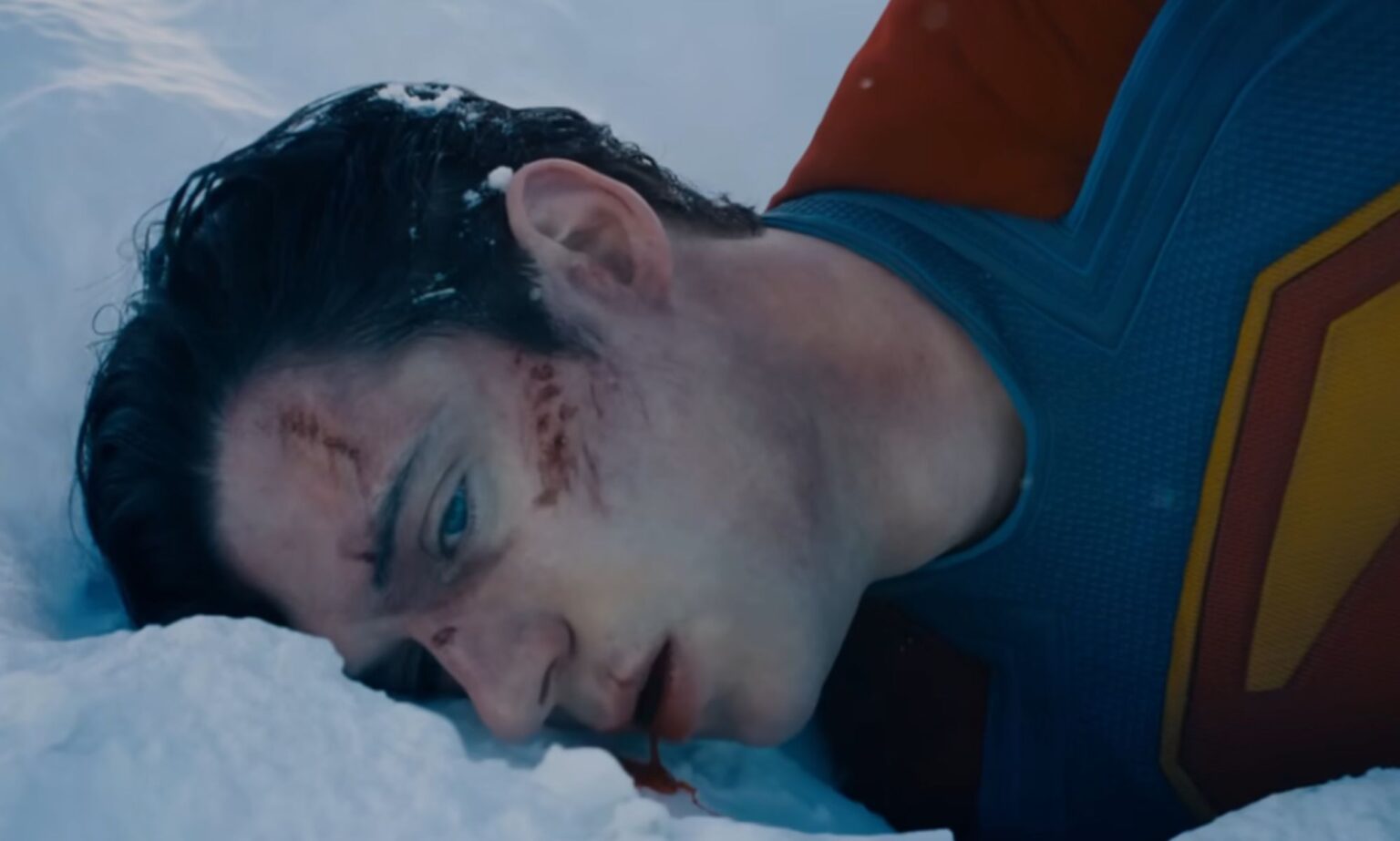 David Corenswet, as Superman, laying in the snow with prosthetic injuries on his face.
