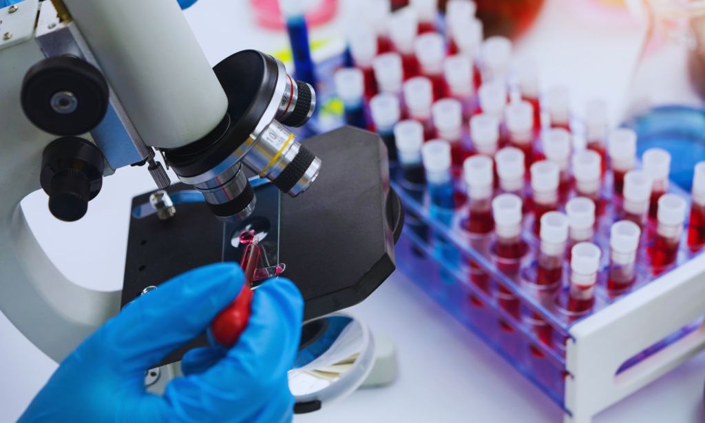 Personne regardant un échantillon de sang au microscope.