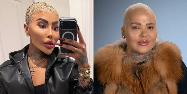 Arrestations effectuées suite au décès de la star de Botched, « Lip King », Jordan James Parke Arrestations effectuées suite au décès de la star de Botched, "Lip King", Jordan James Parke