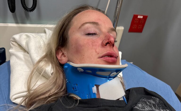 Un couple de lesbiennes poursuit le casino après une prétendue attaque anti-gay brutale : « Ils n’ont rien fait » Celia Haueter suffered severe head injuries in the attack. (GoFundMe)